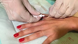 Velká jehla, krve málo. Další Češi si nechali vložit pod kůži čip
