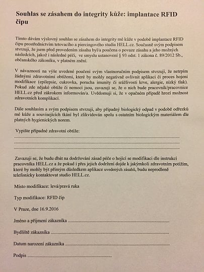 Dokument, který se podepisuje před zahájením implantace.