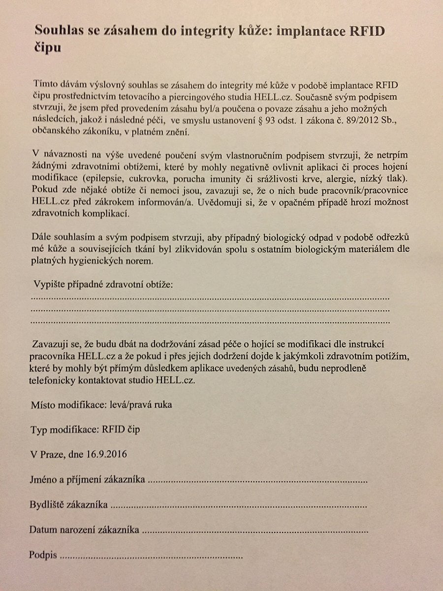 Dokument, který se podepisuje před zahájením implantace.