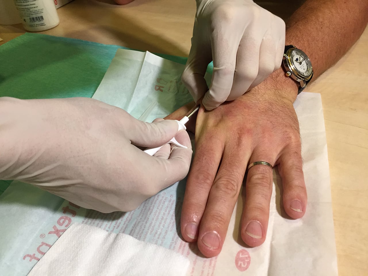Proces vpichování.