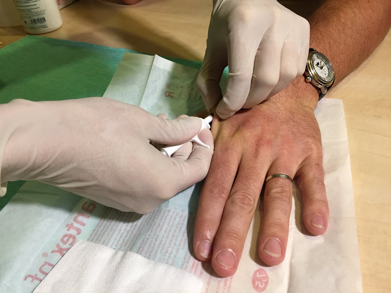 Proces vpichování.
