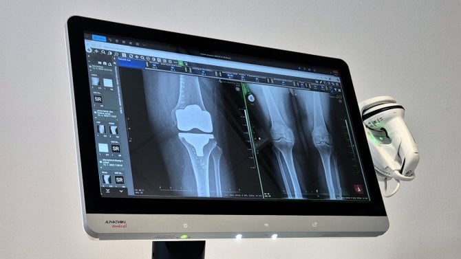 Telemedicina - Vojenska nemocnice Brno - 5G - perex